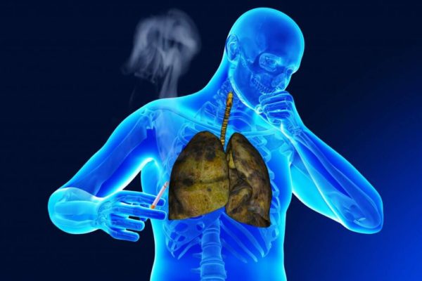 Очищення легенів і бронхів в домашніх умовах: рецепти народної медицини