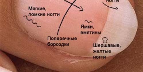 ЩО НІГТІ ГОВОРЯТЬ ПРО НАШЕ ЗДОРОВЯ