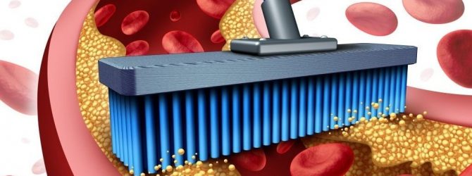 10 суперпродуктів для ефективного очищення артерій і профілактики інфаркту!