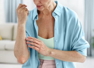 Comprendre le psoriasis : un aperçu complet