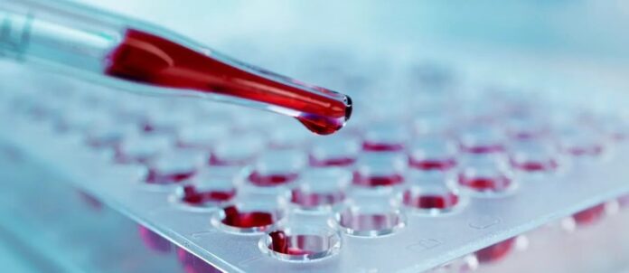 8d33bb01-9c57-4d70-b709-5226fecf6365