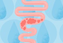 Voda a zácpa: Jasný průvodce úlevou