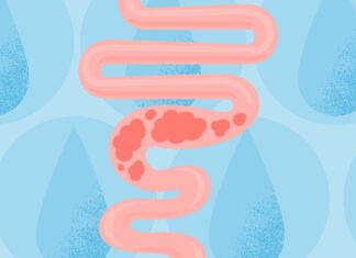 Eau et constipation : un guide clair pour le soulagement