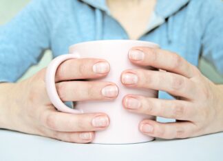 Білі лінії на нігтях: що вони означають насправді