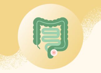 Steigende Rektumkrebssterblichkeit bei Millennials: Ein wachsendes Gesundheitsproblem