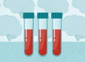 Can a Simple Blood Test Predict Your Risk of Cognitive Decline?